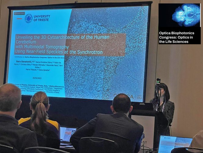 optica_brain_sara_congress